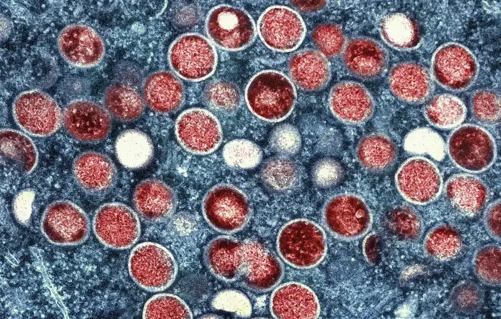Vale do Paraíba e Litoral Norte têm 24 casos de MPOX em 2024