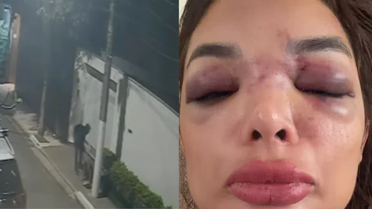 Empresário da Faria Lima é preso suspeito de agredir esposa com taco de beisebol
