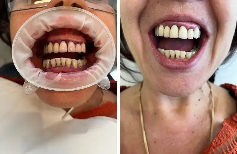 Primeiro Lounge Especializado em Profilaxia Dental com Protocolo GBT é Inaugurado em São Paulo