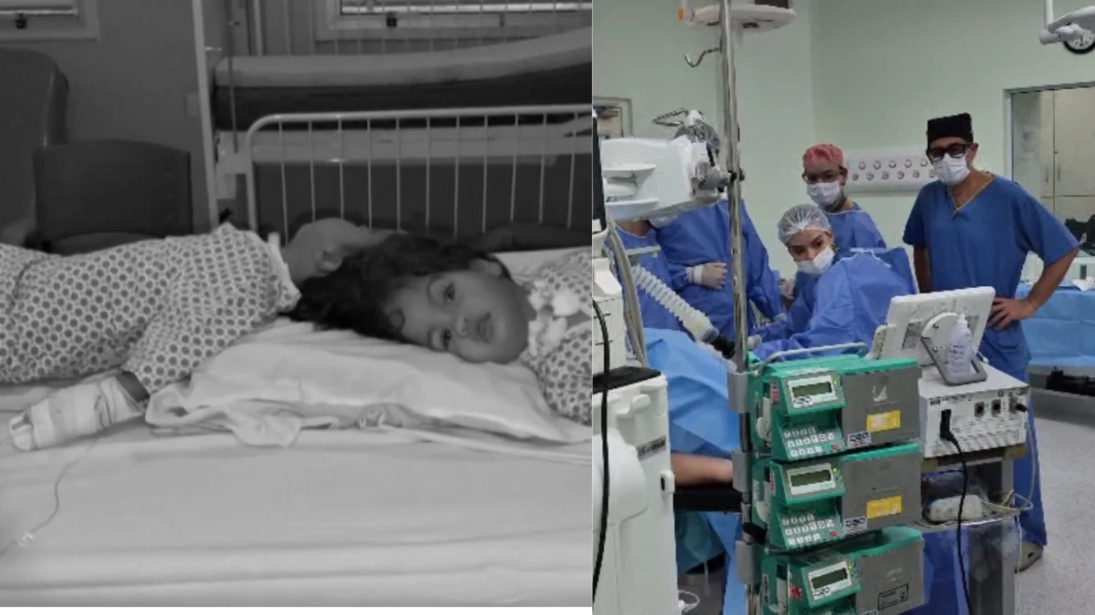 Gêmeas siamesas de São José morrem após cirurgia final de separação