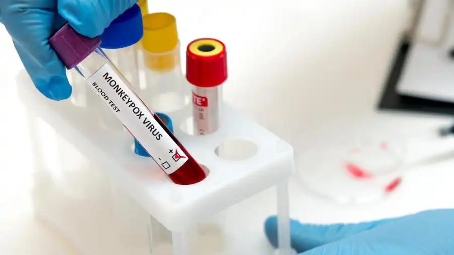 Alerta! Brasil registra primeiro caso de contaminação por nova variante do vírus mpox
