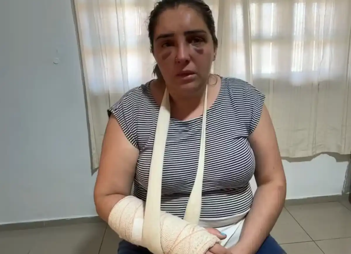 Suspeito de agredir a ex enquanto ela ia à delegacia de São José é preso  