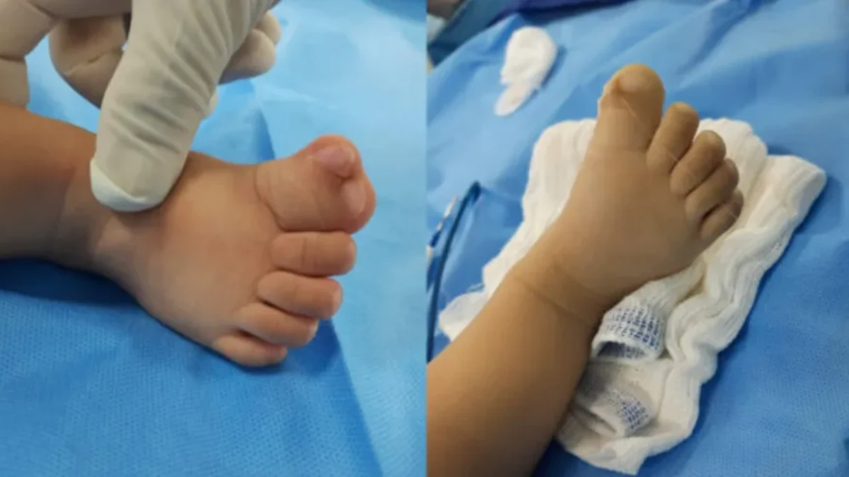 Família faz rifa para pagar cirurgia do bebê, mas médico decide operar de graça