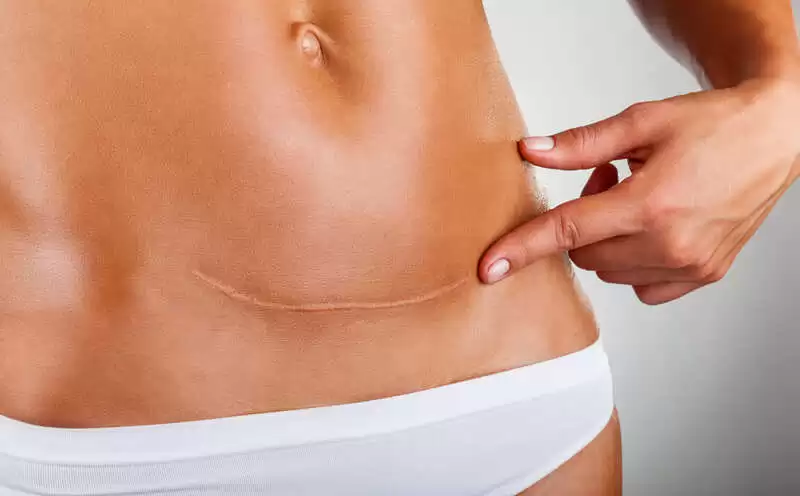 Mulheres vítimas de violência doméstica passam a ter prioridade em cirurgia reparadora