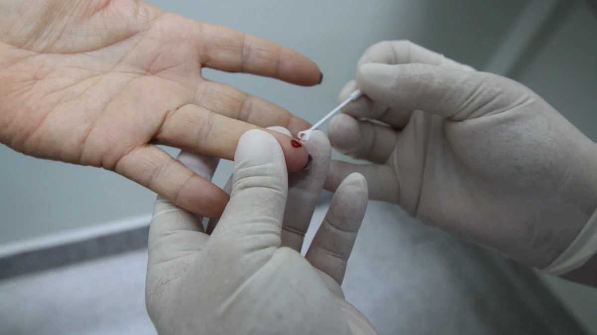 Jacareí oferece testes rápidos gratuitos para HIV, sífilis e hepatites