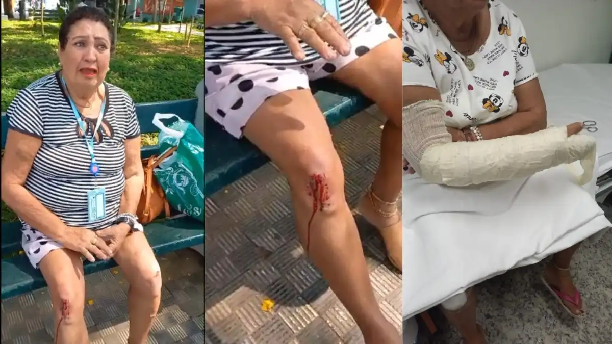 Idosa cai em calçada esburacada e se machuca