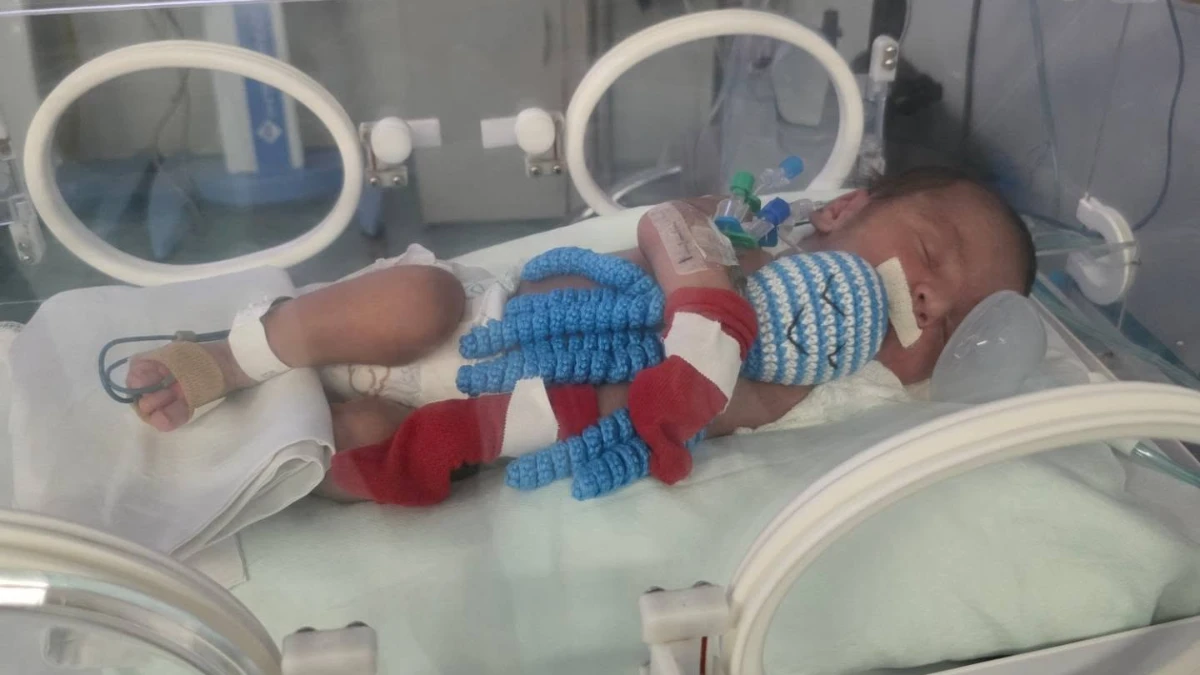 Bebês da UTI neonatal de São José recebem polvos de crochê