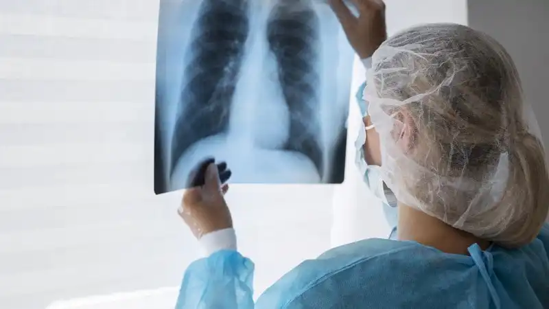 São Paulo recebe investimento inédito no combate à tuberculose