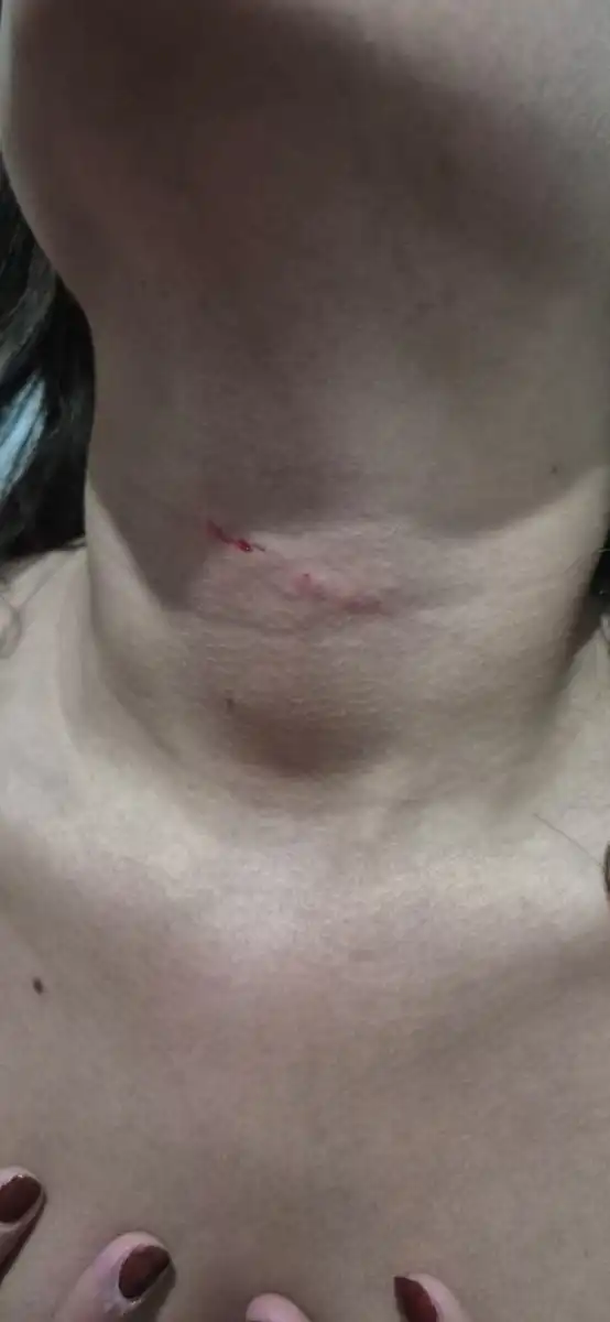 Adolescente de 13 anos é agredida ao sair da escola em São José