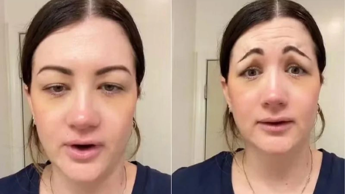 Botox deu errado? Saiba quais são os cuidados e os direitos do consumidor
