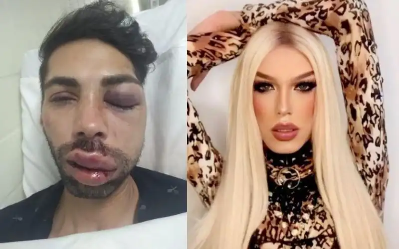 Polícia prende suspeito de espancar Miss Gay em São José