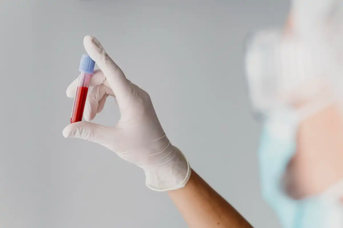 País registra aumento de 168% nos casos de HIV entre os jovens