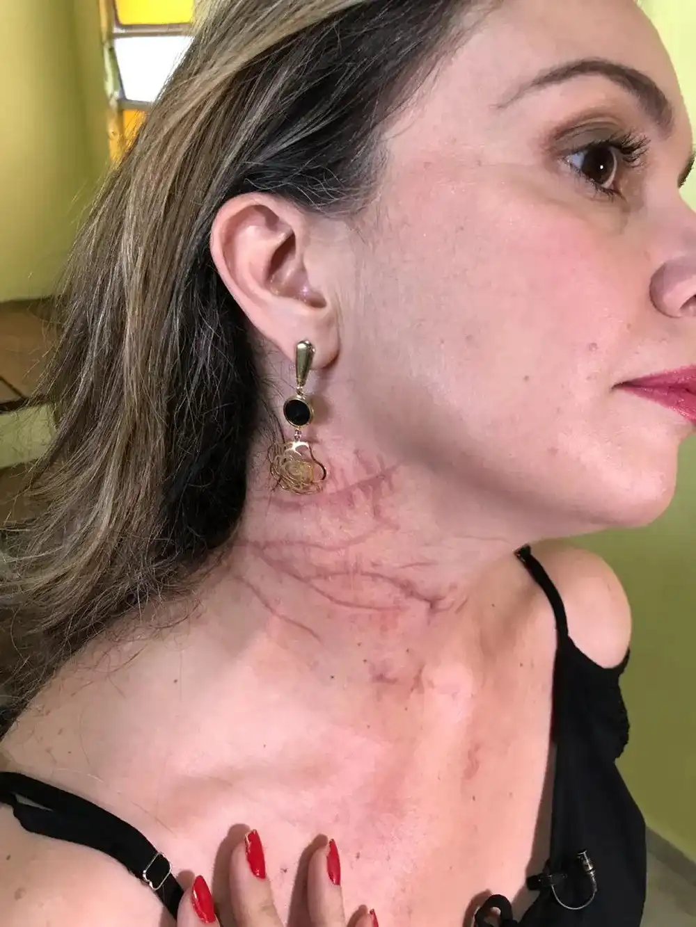 Homem que tentou matar ex com 70 facadas vai para semiaberto por bom comportamento