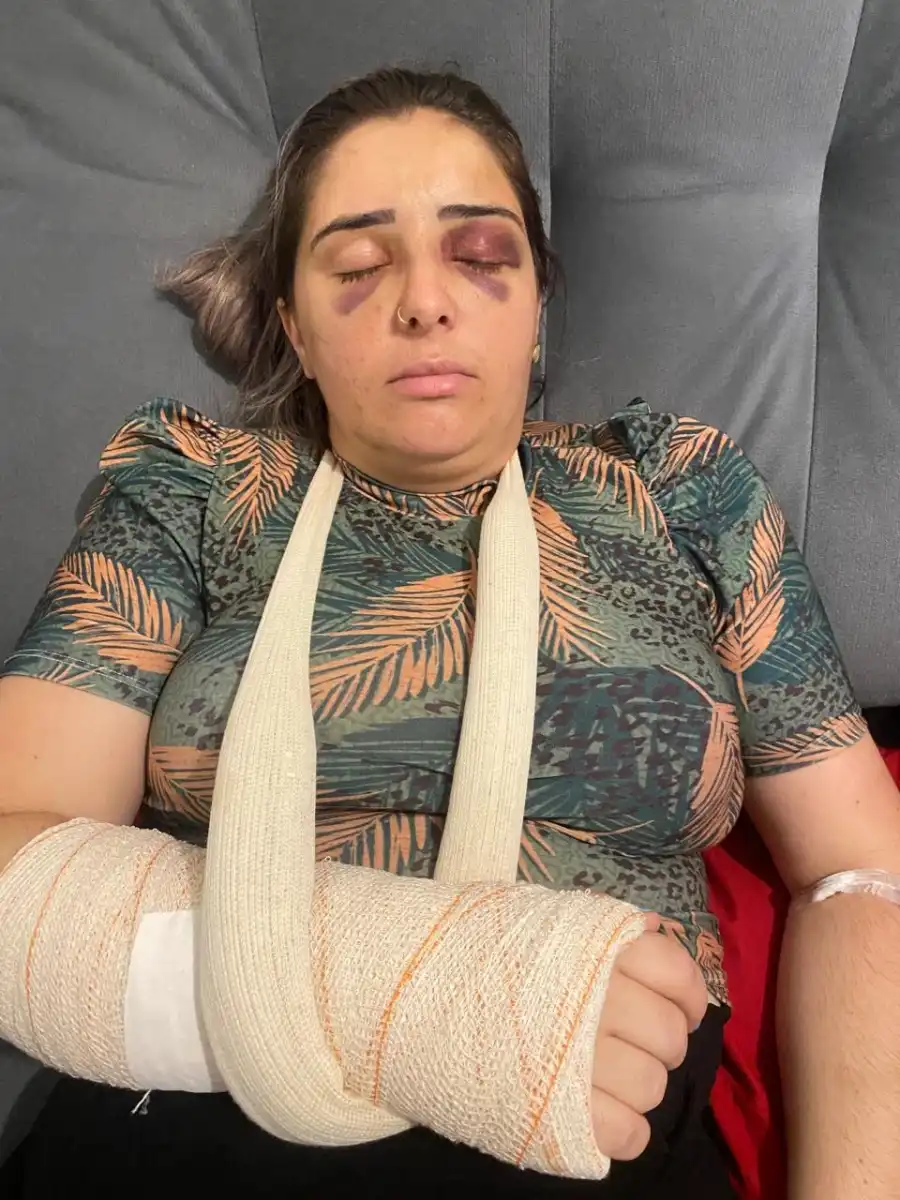 Mulher é agredida e tem o pulso quebrado pelo ex-companheiro em São José
