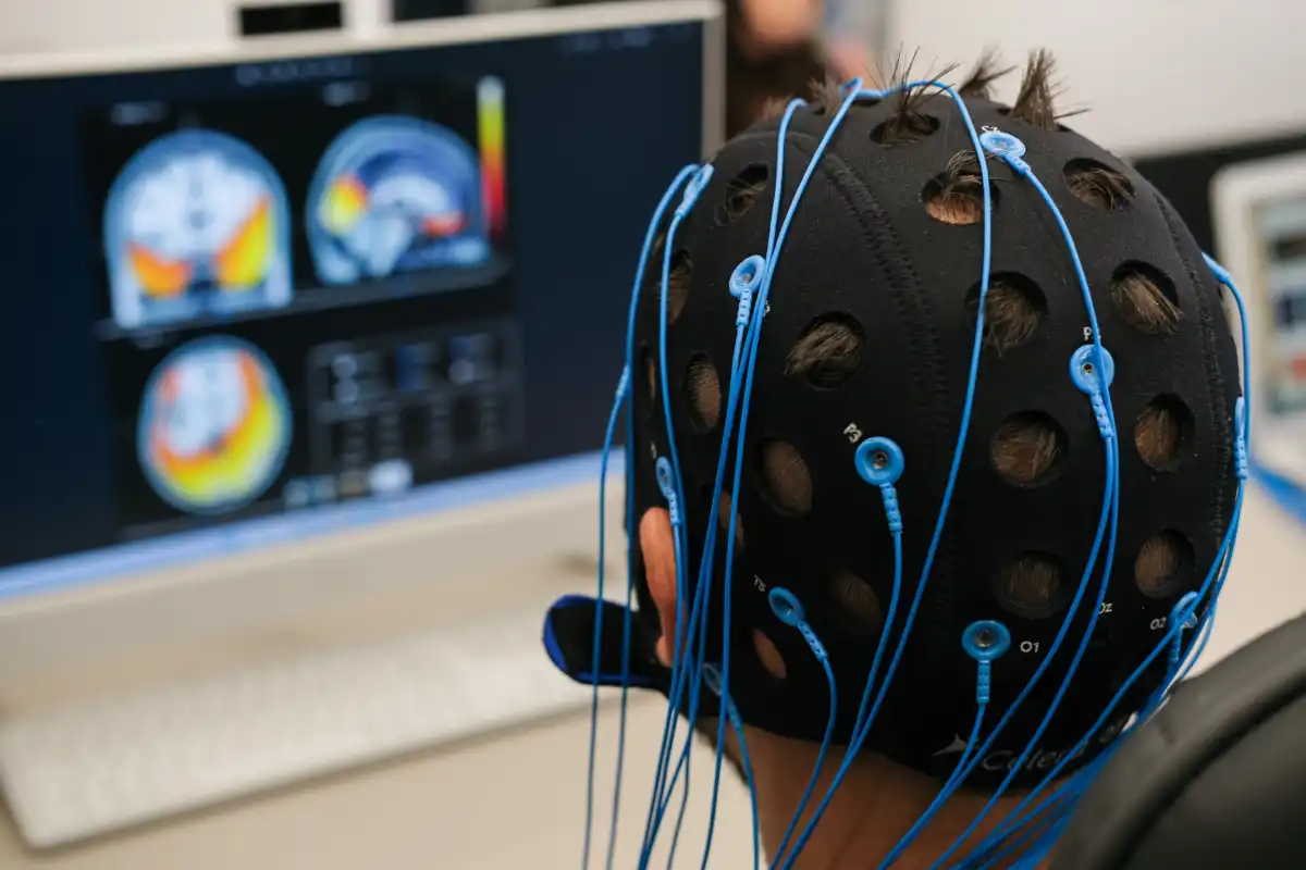 Mapeamento cerebral pode auxiliar no diagnóstico de doenças neurológicas