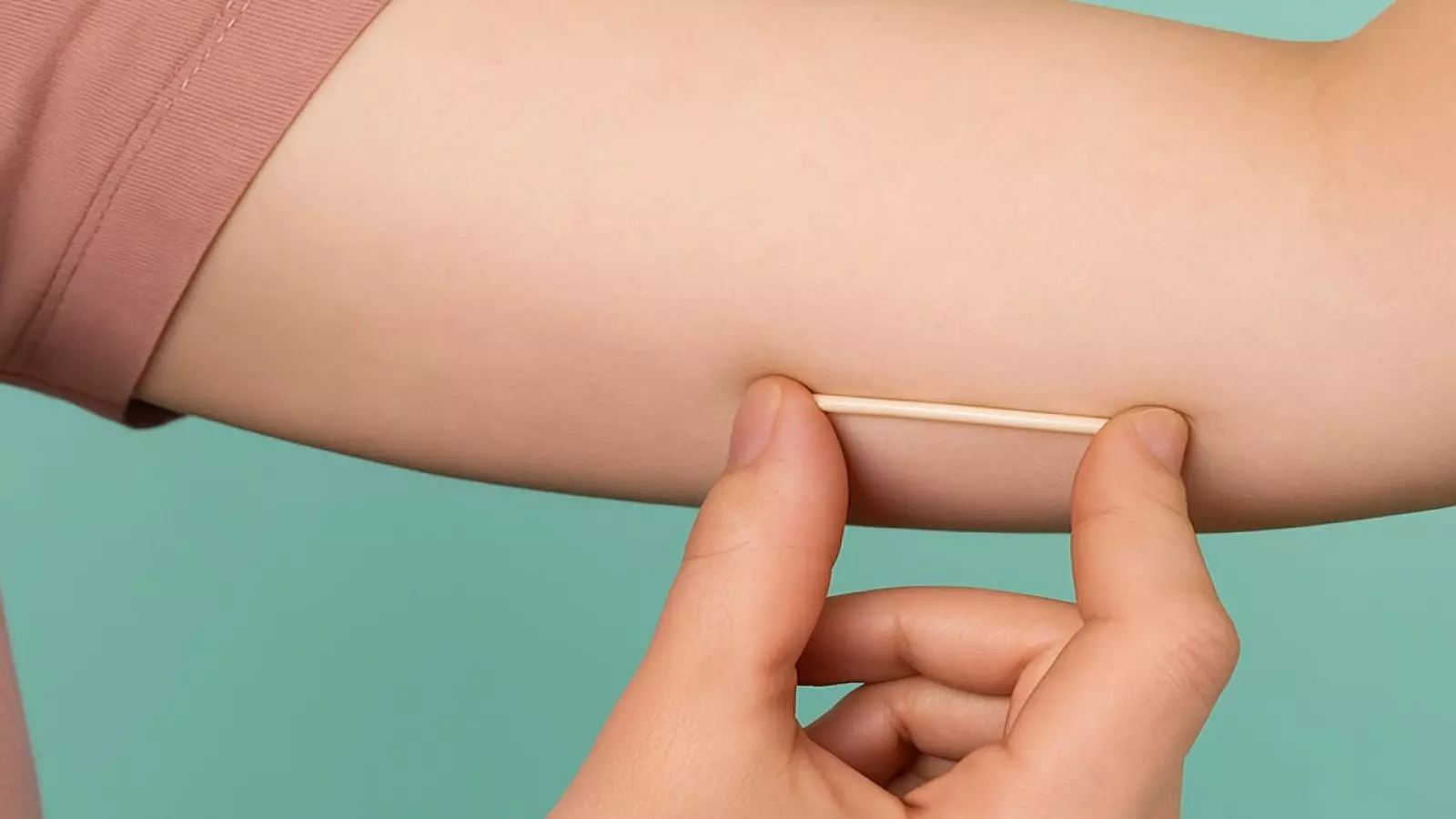 Implanon para todos: Implante contraceptivo passa a ter cobertura obrigatória nos planos de saúde