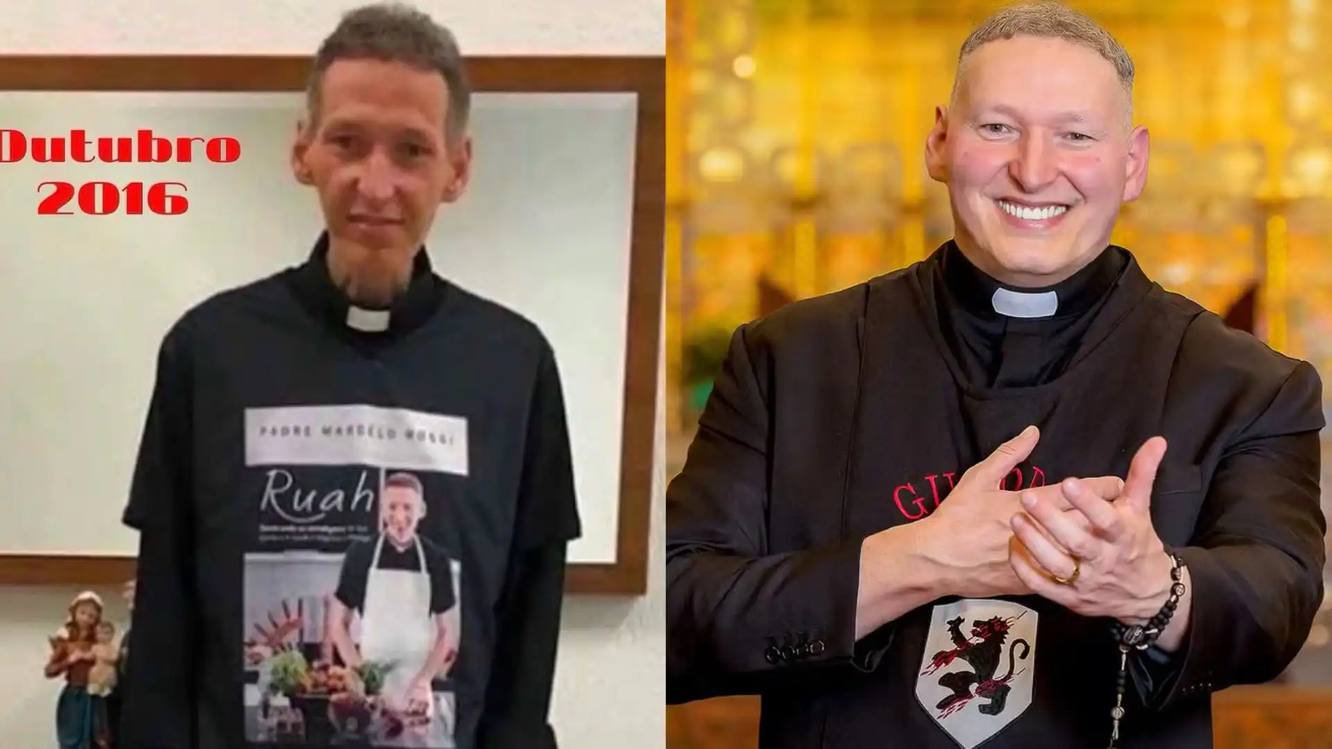 Padre Marcelo Rossi mostra antes e depois após depressão e emociona seguidores