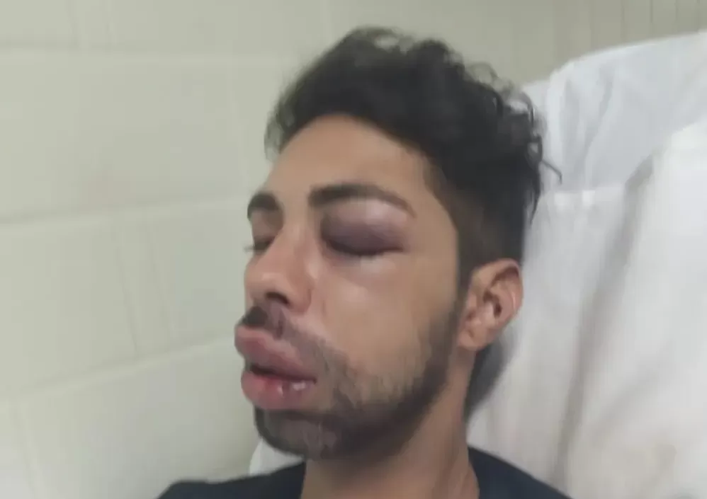 Homem espancado foi primeiro caso registrado oficialmente como homofobia, em São José dos Campos