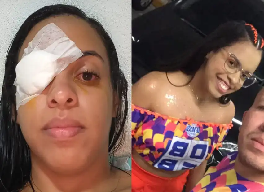 Pomadas para trançar e modelar cabelo: Anvisa proíbe a venda de todas as marcas; razões incluem risco de cegueira temporária