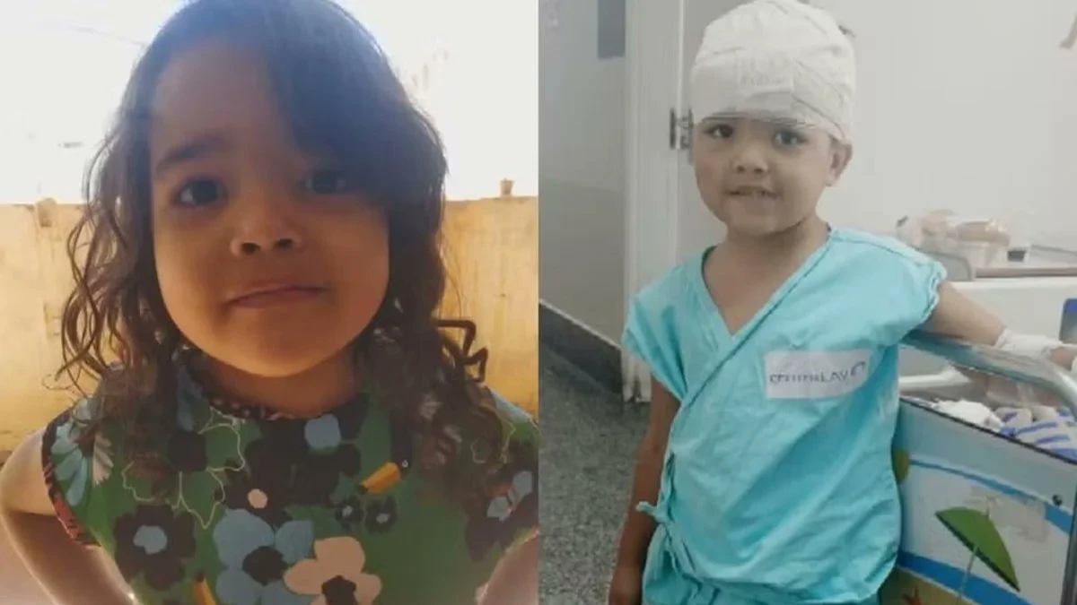 Menina de 4 anos é atacada por pit bull e fará cirurgia para reconstruir couro cabeludo