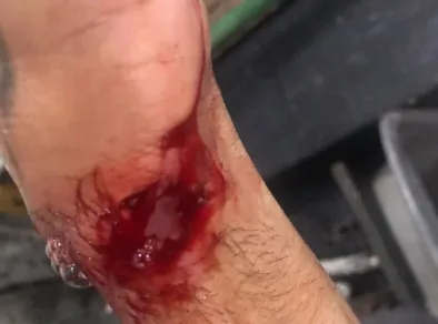 Homem é esfaqueado após tentativa de assalto em semáforo de São José