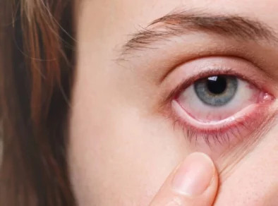 Veja como hábitos do dia a dia podem acarretar sintomas de olho seco