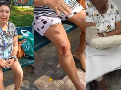 Idosa cai em calçada esburacada e se machuca