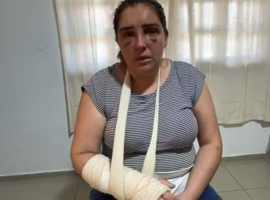 Suspeito de agredir a ex enquanto ela ia à delegacia de São José é preso  