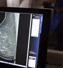 Tecnologia do micro-ondas propõe alternativa mais confortável e acessível à mamografia…