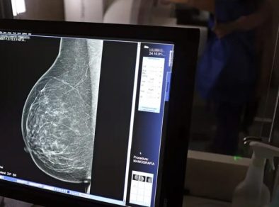 Tecnologia do micro-ondas propõe alternativa mais confortável e acessível à mamografia tradicional, mostra estudo