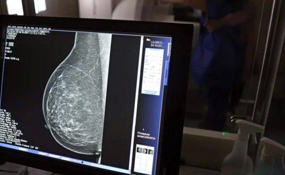 Tecnologia do micro-ondas propõe alternativa mais confortável e acessível à mamografia tradicional, mostra estudo