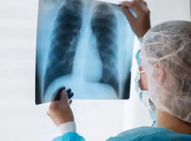 “Eu nunca fumei” – Por que pessoas não fumantes estão enfrentando câncer de pulmão?