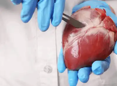 Brasil bate recorde de transplantes e anuncia novas medidas para agilizar doações