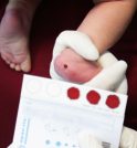 Ampliação do Teste do Pezinho pode rastrear até 54 doenças raras
