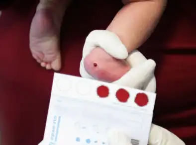 Ampliação do Teste do Pezinho pode rastrear até 54 doenças raras