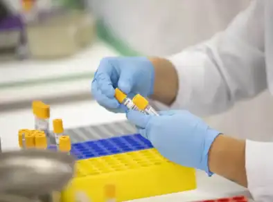 Prefeitura de Taubaté inicia descentralização de coletas de exames nesta segunda-feira (16)