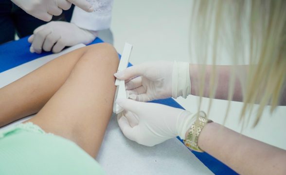 SUS vai oferecer implante contraceptivo de graça a partir do segundo semestre
