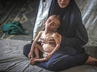 Fome é confirmada em Gaza pela primeira vez, ONU pede ajuda urgente