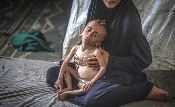 Fome é confirmada em Gaza pela primeira vez, ONU pede ajuda urgente