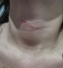 Adolescente de 13 anos é agredida ao sair da escola em…