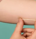 Implanon para todos: Implante contraceptivo passa a ter cobertura obrigatória nos…