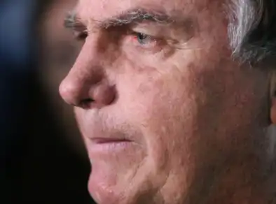 Laudo médico aponta câncer de pele nas lesões de Bolsonaro