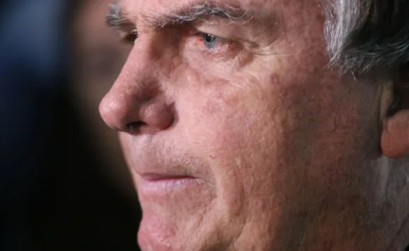 Laudo médico aponta câncer de pele nas lesões de Bolsonaro