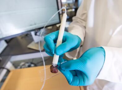 Pesquisadora brasileira cria caneta que detecta câncer em 10 segundos